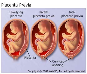 Prévia 2021-22: Divisão Central - NHeLas